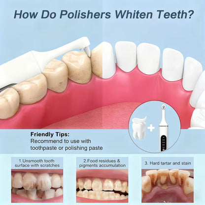 The Teeth Polisher™